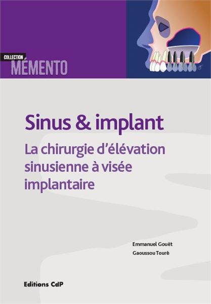 Sinus & implant