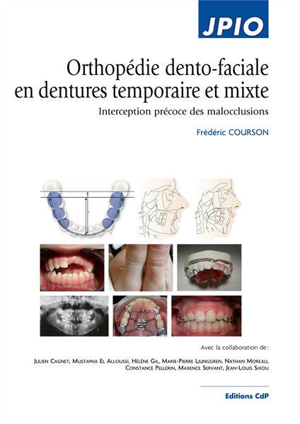 Orthopédie dento-faciale en dentures temporaire et mixte