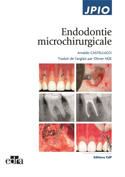 Endodontie microchirurgicale