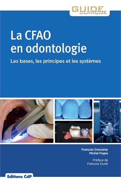 La CFAO en odontologie