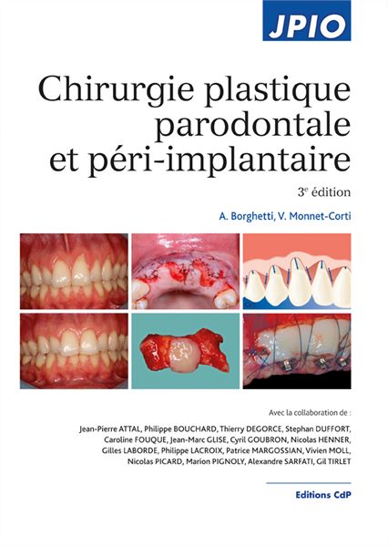 Chirurgie plastique parodontale et péri-implantaire - 3e édition