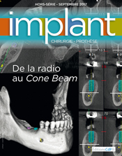 De la radio au Cone Beam - Hors-Série 2017 Revue Implant