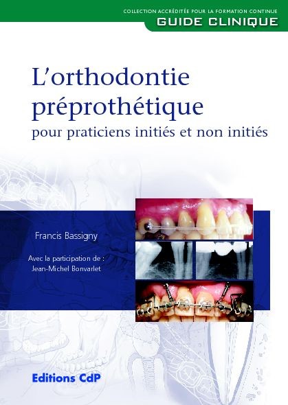 L'orthodontie préprothétique