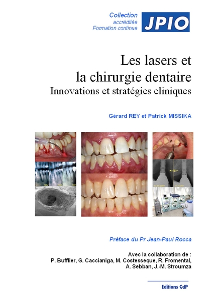 Les lasers et la chirurgie dentaire