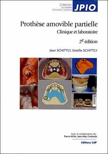 Prothèse amovible partielle  - 2e édition